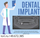 Doctor examines x-ray of human jaw with normal teeth and dental implant. Male radiologist diagnoses tooth after dental procedure. Surgical implant in oral cavity. Radiograph with prosthesis. Doctor examines x-ray with healthy teeth and dental implant. Radiologist diagnoses human jaw. Стоковая иллюстрация, агентство Ingram Publishing / Фотобанк Лори