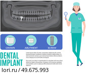 Female doctor talking about dental prosthesis structure. Implantation dentistry, stomatology. Tooth care, treatment. Dental implant creation scheme. Sequence of connection of screw, abutment and crown. Female doctor talking about prosthesis structure. Dentist works with dental implant creation scheme. Стоковая иллюстрация, агентство Ingram Publishing / Фотобанк Лори