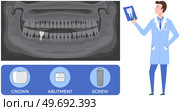 Doctor talking about dental prosthesis structure. Implantation dentistry, stomatology. Tooth care, treatment. Dental implant creation scheme. Sequence of connection of screw, abutment and crown. Doctor talking about prosthesis structure. Dentist works with dental implant creation scheme. Стоковая иллюстрация, агентство Ingram Publishing / Фотобанк Лори