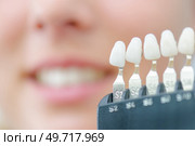 a set of false teeth. Стоковое фото, агентство Ingram Publishing / Фотобанк Лори