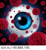 Eye cancer concept or intraocular cancers symbol as a human eyeball with cancerous cells spreading as a health care and medical icon for ocular tumor risk resulting in vision loss and blindness. Стоковое фото, агентство Ingram Publishing / Фотобанк Лори