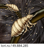 Lice in hair problem as a medical concept with a macro close up of a human head with an infestation of parasitic nits or eggs hatching from a louse insect as a symbol of infection and treatment. Стоковое фото, агентство Ingram Publishing / Фотобанк Лори