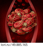 Blood clot and thrombosis medical illustration concept as a group of human blood cells clumped together by sticky platelets and fibrin creating a blockage in an artery or vein as a health disorder symbol for circulatory system danger. Стоковое фото, агентство Ingram Publishing / Фотобанк Лори