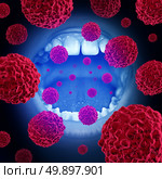 Oral cancer medical concept as a mouth with malignant disease cells with 3D illustration elements. Стоковое фото, агентство Ingram Publishing / Фотобанк Лори