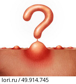 Dermatology and acne skin questions health care concept as a group of pimples or sores on human skin shaped as a question mark as a medical anatomy symbol for a skincare epidermis disorder in a 3D illiustration style on white. Стоковое фото, агентство Ingram Publishing / Фотобанк Лори