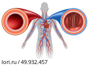 Artery and vein structure as a human circulation concept with blood vessels close up in a 3D illustration style. Стоковое фото, агентство Ingram Publishing / Фотобанк Лори