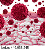 Interstitium and cancer concept as connective tissue with comparments filled with fluid as a microscopic conceptual human body part with malignant cells in a 3D illustration style.. Interstitium And Cancer. Стоковое фото, агентство Ingram Publishing / Фотобанк Лори