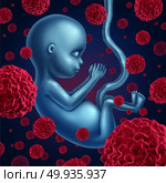 Fetus cancer and fetal illness as a prenatal malignant disease and a health symbol for tumor metastasizing with 3D illustration elements.. Fetus Cancer. Стоковое фото, агентство Ingram Publishing / Фотобанк Лори