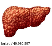Fatty liver and hepatic steatosis body part isolated on white as a medical health care concept of the digestive system anatomy and vital organ for digestion functions in a 3D illustration style. Стоковое фото, агентство Ingram Publishing / Фотобанк Лори