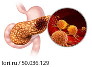 Pancreatic cancer anatomy concept and Pancreas malignant tumor symbol as a digestive gland body part with a microscopic magnification of malignant tumor cells dividing and spreading with 3D illustration elements. Стоковое фото, агентство Ingram Publishing / Фотобанк Лори