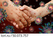 Viral diseases and measles disease and or virus illness as a contagious chickenpox or a skin rash spreading with contagious cells with 3D illustration elements. . Стоковое фото, агентство Ingram Publishing / Фотобанк Лори