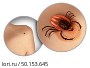 Deer tick crawling on skin as a lyme disease health danger as the bite of a parasite causing infection in a 3D illustration style. Стоковое фото, агентство Ingram Publishing / Фотобанк Лори