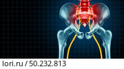 Painful sciatica nerve symptom and pain diagnosis as a medical concept for a disease causing physical problems with 3D illustration elements. Стоковое фото, агентство Ingram Publishing / Фотобанк Лори