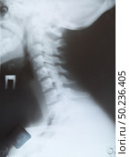 RX diagnostic of neck. Element of design. Стоковое фото, агентство Ingram Publishing / Фотобанк Лори