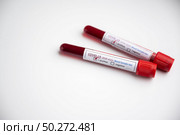 Blood test samples for presence of coronavirus (COVID-19) tube containing a blood sample that has tested positive for coronavirus. Стоковое фото, агентство Ingram Publishing / Фотобанк Лори