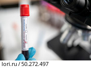 Blood test samples for presence of coronavirus (COVID-19) tube containing a blood sample that has tested positive for coronavirus. Стоковое фото, агентство Ingram Publishing / Фотобанк Лори