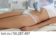 Cosmetologist performing cryotherapy using cooling attachment to tighten skin on female client belly in cosmetology clinic. Non-surgical body sculpting concept. Стоковое видео, видеограф Яков Филимонов / Фотобанк Лори