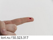bleeding finger. Стоковое фото, агентство Ingram Publishing / Фотобанк Лори