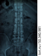 x ray vertebral column. Стоковое фото, агентство Ingram Publishing / Фотобанк Лори