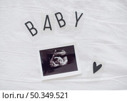 x ray fetus white sheets. Стоковое фото, агентство Ingram Publishing / Фотобанк Лори