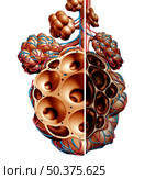 Emphysema as shortness of breath, lung disorder as a COPD illness and Chronic obstructive pulmonary disease medical concept as bronchioles and alveoli are damaged as a 3D illustration, Стоковое фото, агентство Ingram Publishing / Фотобанк Лори