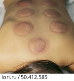 client after suction cup process. Стоковое фото, агентство Ingram Publishing / Фотобанк Лори