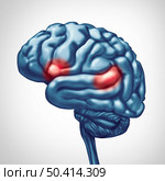 Aphasia brain disorder concept as damage to the human mind disease resulting in problems with speech and language ability  in a 3D illustration style. Стоковое фото, агентство Ingram Publishing / Фотобанк Лори