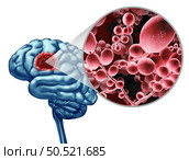 Deadly Brain Fungal Infection concept as a microbe threat and mucormycosis life threatening fungus as Candida auris fungi spreading in the nervous system as a 3D illustration. Стоковое фото, агентство Ingram Publishing / Фотобанк Лори