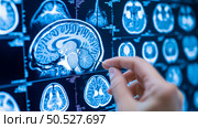 Neurological Examination: Analyzing Brain Scans on a Medical Display. Стоковое AI-изображение, AI-художник Данила Большаков / Фотобанк Лори
