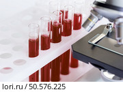blood in glass tubes on background of microscope. Стоковое фото, агентство Ingram Publishing / Фотобанк Лори