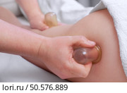 The masseur makes massage with jars of cellulite on the buttock and thighs of the patient. Treatment of excess weight. Стоковое фото, агентство Ingram Publishing / Фотобанк Лори