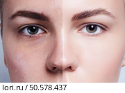 Before and after cosmetic operation. Young pretty woman portrait, isolated on a white background. Before and after cosmetic or plastic procedure, anti-age therapy. Before and after cosmetic operation. Young pretty woman portrait. Стоковое фото, агентство Ingram Publishing / Фотобанк Лори