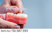 Close-up. The doctor puts transparent aligners on the teeth of the artificial jaw. Invisible and removable aligners for teeth alignment. Стоковое фото, агентство Ingram Publishing / Фотобанк Лори