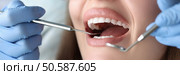 Dentist conducts medical examination of patient teeth. Dental clinic services concept. Dentist conducts medical examination of patient teeth. Стоковое фото, агентство Ingram Publishing / Фотобанк Лори