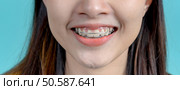 Smiling Asian woman wearing orthodontic retainer on blue screen background. Dental care and healthy teeth. Стоковое фото, агентство Ingram Publishing / Фотобанк Лори