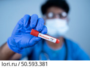 close up shot of doctor showing Monkeypox positive test of laboratory blood sample - concept of virus outbreak or spreading infection. Стоковое фото, агентство Ingram Publishing / Фотобанк Лори