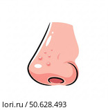 Нос с угревой сыпью, черными точками и воспалением, прыщами/Illustration of a nose with acne, blackheads and pimples, dermatology concept. Стоковое AI-изображение, AI-художник Александра Кабанова / Фотобанк Лори