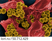 Scanning electron micrograph of Staphylococcus and a dead human neutrophil. Стоковое фото, фотограф National Institutes of Health /Stocktrek/Stocktrek Images / ТАСС / Фотобанк Лори