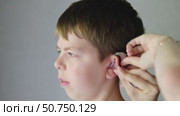 Mother puts hearing aid with individual plastic earmolds on the ear of an 10 year old boy. Sensorineural hearing loss of a little boy. Стоковое видео, видеограф Кашапова Эльвира / Фотобанк Лори