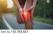Joint problems and tendon inflammation. Sporty woman who suffered a knee accident during the run. Стоковое AI-видео, аниматор Sergey Grishin / Фотобанк Лори