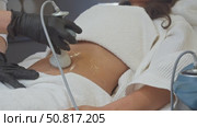 skincare specialist conducting a procedure on a patient's abdomen while the patient stays relaxed on a towel-covered surface. Стоковое видео, видеограф Strunov David / Фотобанк Лори