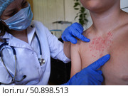 The physician is inspecting the boy's skin for health issues. Стоковое фото, фотограф Ирина Старикова / Фотобанк Лори