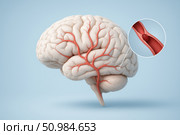 Detailed digital rendering of a human brain with highlighted artery blockage, visualizing ischemic stroke pathway for medical or educational use. Стоковое AI-изображение, AI-художник Башкирова Анна / Фотобанк Лори