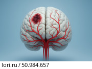 Digital medical rendering of human brain with blood vessels and localized vascular dementia damage, ideal for neurology or educational visuals. Стоковое AI-изображение, AI-художник Башкирова Анна / Фотобанк Лори