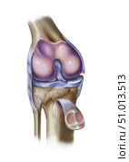 Front view of knee showing torn medial collateral ligament. Стоковое фото, фотограф Elise Walmsley-MacWha/Stocktrek Images / ТАСС / Фотобанк Лори