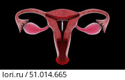 Biomedical illustration of an intrauterine device in position inside the female uterus. Стоковое фото, фотограф Stocktrek Images, Inc. / ТАСС / Фотобанк Лори