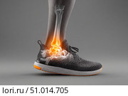 Leg with ankle joint pain icon. Foot wearing running shoes showing the bones in the ankle area. Grey floor. Feet with red effect of painful injury problems. Legs with anatomical detail glowing orange. Стоковое AI-изображение, AI-художник Марина Демидюк / Фотобанк Лори