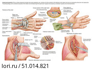 Medical illustration showing carpal tunnel syndrome in the human wrist. Стоковое фото, фотограф Stocktrek Images, Inc. / ТАСС / Фотобанк Лори
