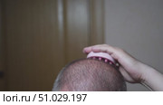 A man with early-stage hair loss massages his scalp with a spiked silicone brush to stimulate blood circulation and hair growth. Стоковое видео, видеограф Татьяна Степанищева / Фотобанк Лори