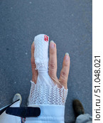 A person's hand with a bandage on a finger made of white mesh medical elastic tubular fixation. A small blood stain is visible on the tip of the bandage, indicating a fresh injury or recent surgery. The fingers, except for the bandaged one, are free and visible with neat long nails. The person is wearing a light jacket, and in the background is an asphalt surface, slightly blurred. The frame conveys the moment of recovery from an injury and can illustrate the themes of health, medicine and care. Стоковое фото, фотограф Анна Кривицкая / Фотобанк Лори